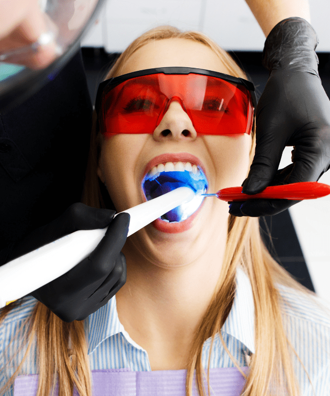 WHITENING OF TEETH WITH LAZER